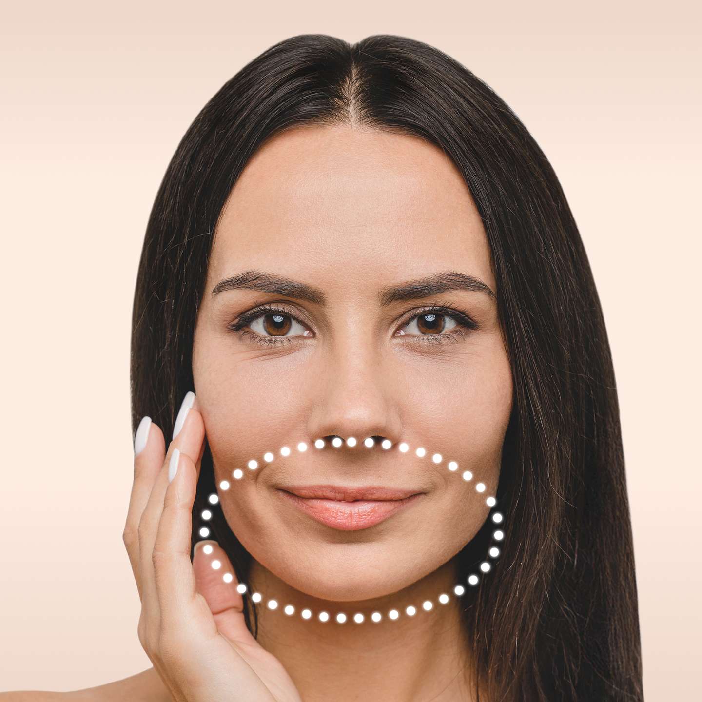 Bild eines Modells Mona Lisa Lift Behandlung glowtox